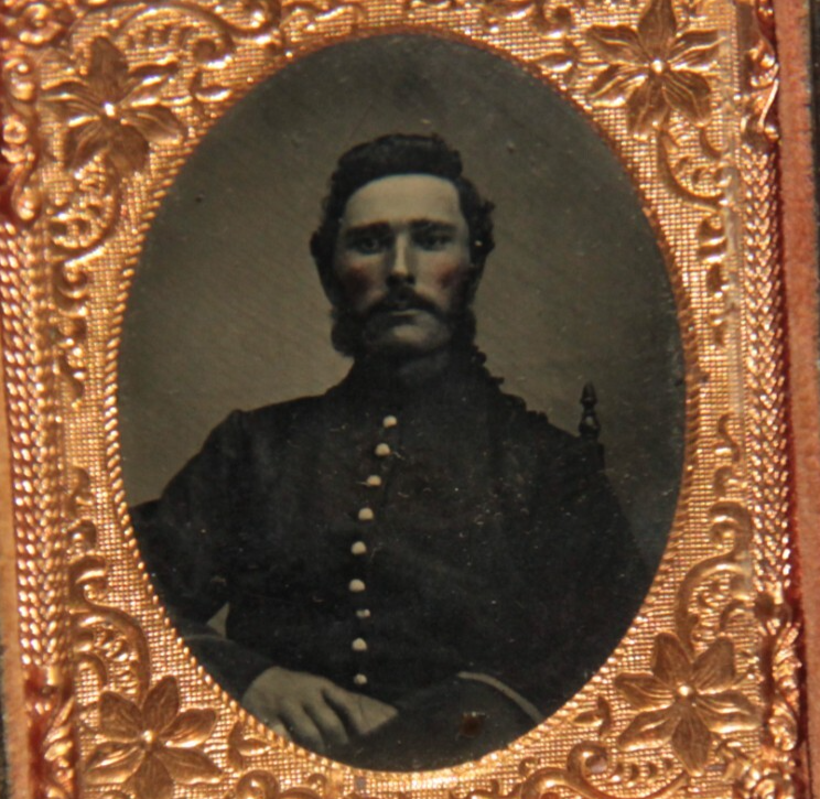 Civil War Ambrotype 9th Plate Union Officer Soldier – Rosy Cheeks